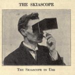 image of a man looking through a device called a skiascope
